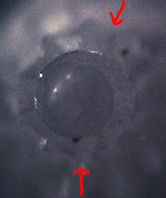 Identificazione di una Mangelia